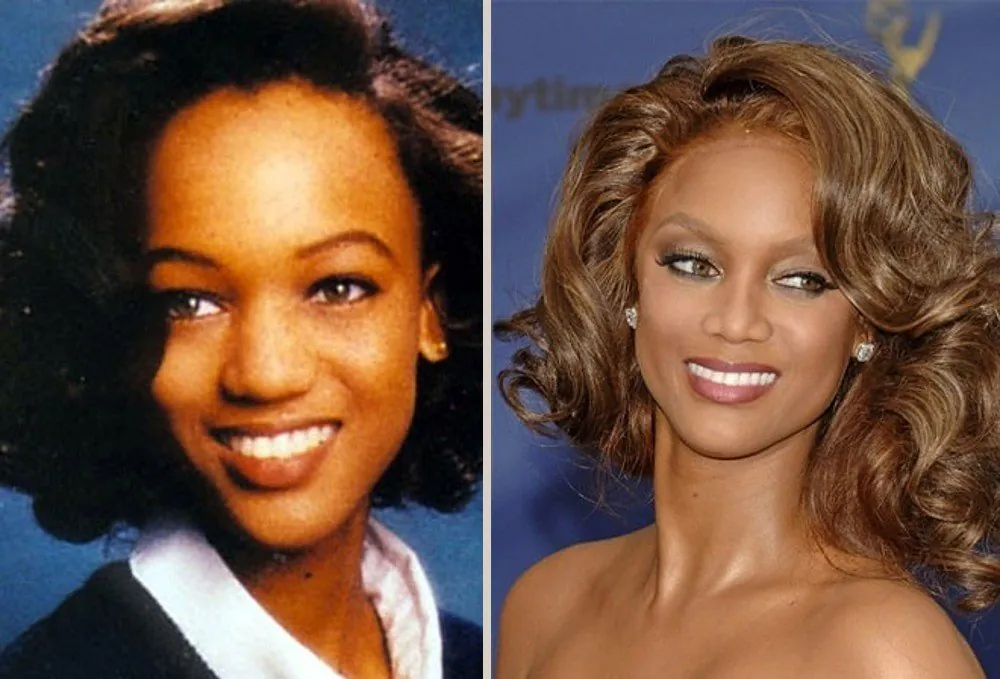 7 casos exitosos de cirugías plasticas de celebridades