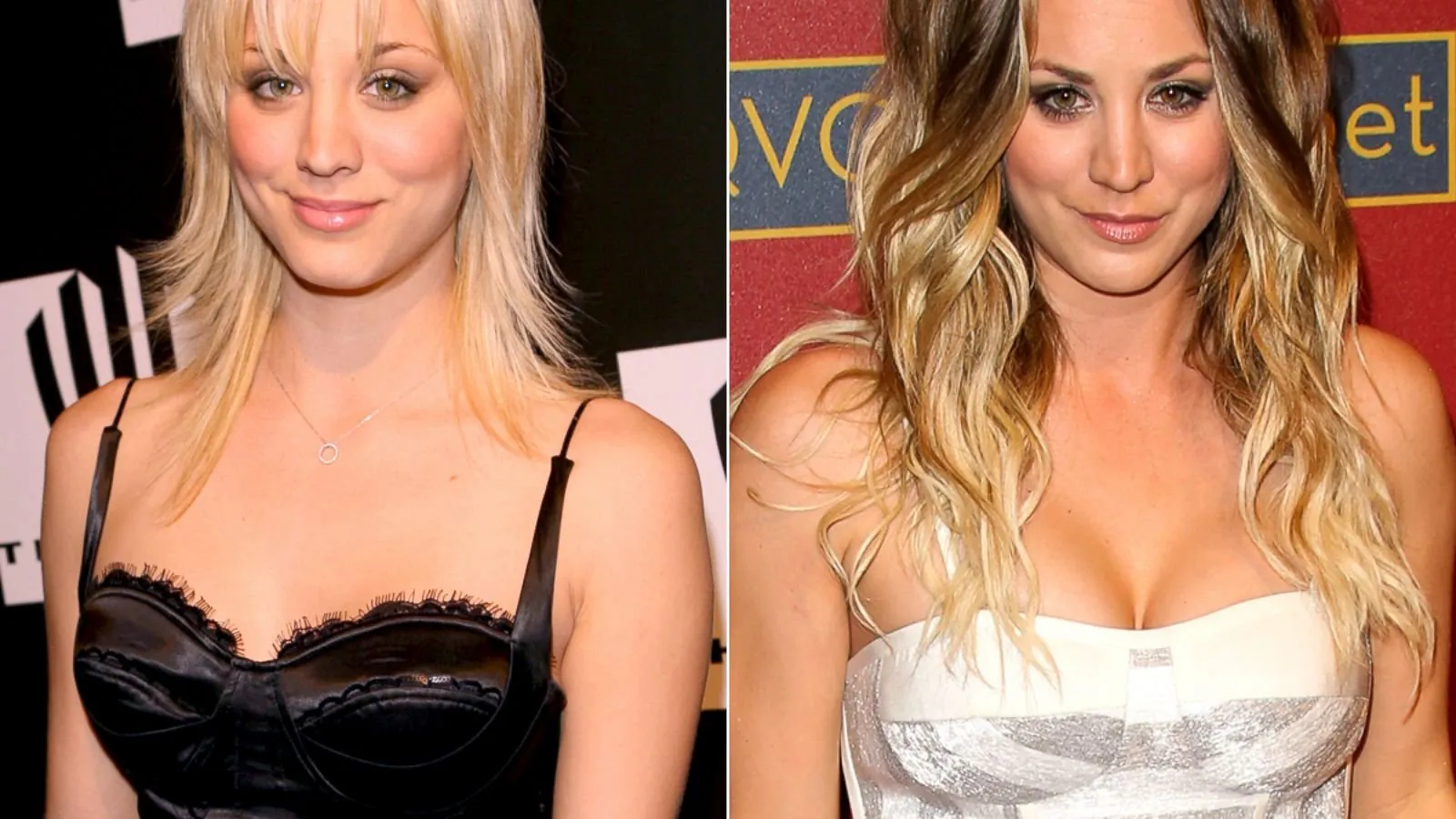 7 casos exitosos de cirugías plasticas de celebridades