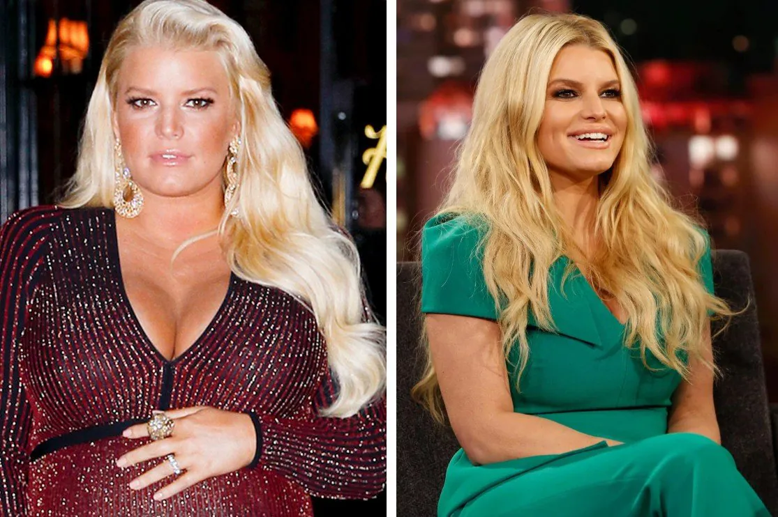 7 casos exitosos de cirugías plasticas de celebridades