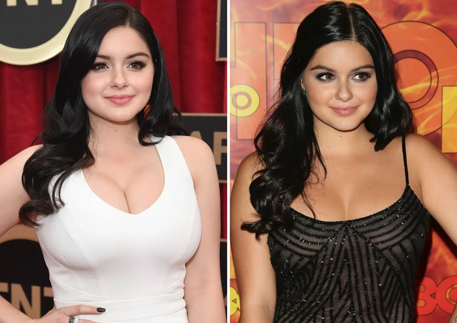 7 casos exitosos de cirugías plasticas de celebridades
