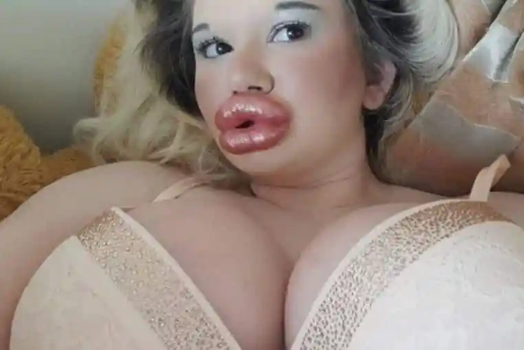 femme plus grosses lèvres (1)