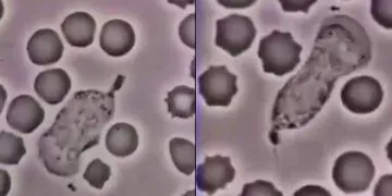 globule blanc