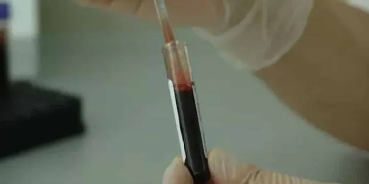 Les scientifiques développent un test pour prédire quand vous mourrez