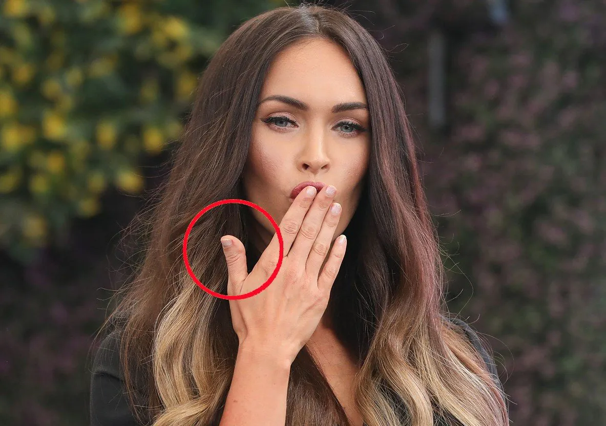 Brachydactylie de type D, Nez, Peau, Menton, Main, Sourcil, Cils, Gens dans la nature, Photographie au flash, Cou