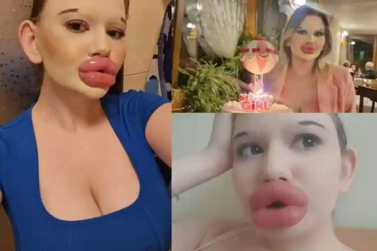 femme plus grosses lèvres (1)
