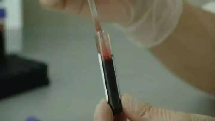 Les scientifiques développent un test pour prédire quand vous mourrez