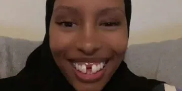 combler trou dent dentiste rajoute