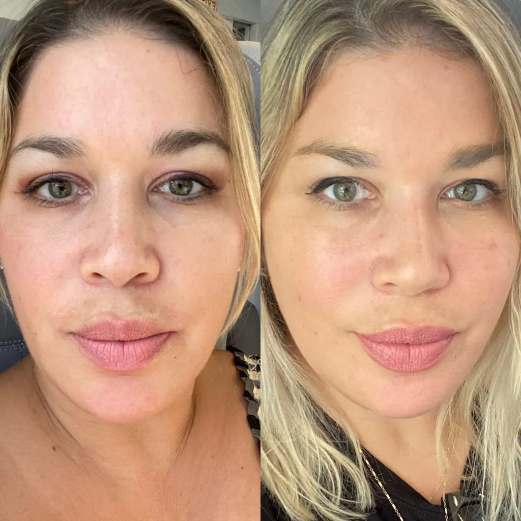 Ce qui a le mieux fonctionné pour ma peau à 45 ans
