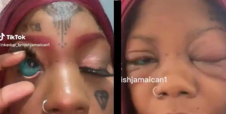 Elle se fait tatouer le blanc des yeux et devient peu à peu aveugle !  (Vidéo)