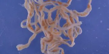 Il a un ténia de 1,7 mètre dans l'estomac après avoir abusé du sashimi