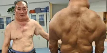 Il boit 1 litre d'alcool par jour depuis qu'il a 13 ans, voici le résultat sur son corps !