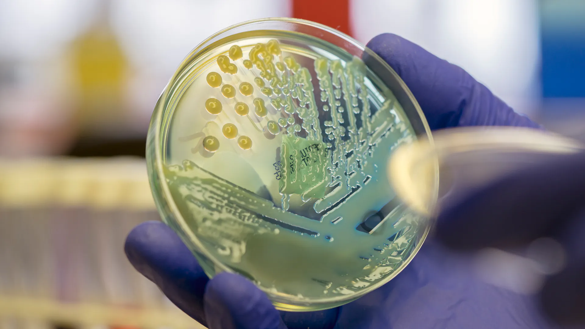 Microbiologiste examinant une bactérie coliforme multirésistante (Klebsiella pneumoniae) sur une plaque de gélose CLED