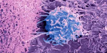 Les traitements du cancer de la prostate peuvent être évités ou retardés dans de nombreux cas, selon une vaste étude