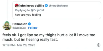 Doja Cat se remet de 2 chirurgies mammaires et d'une lipo