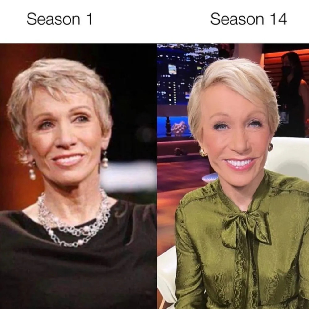 Barbara Corcoran révèle qu'elle a eu 2 liftings