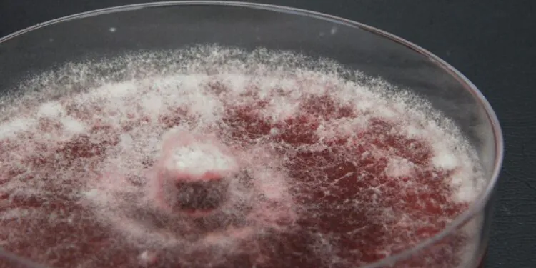 Épidémie mortelle de méningite fongique liée à des procédures cosmétiques au Mexique