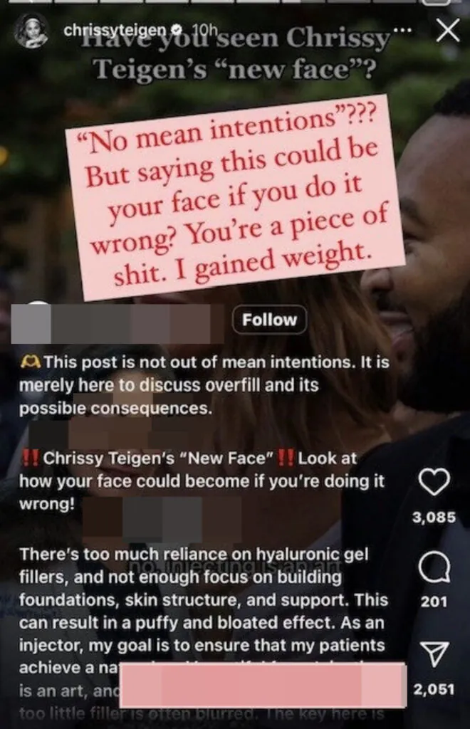 Chrissy Teigen a répondu à un commentaire Instagram qui interrogeait son « nouveau visage ».