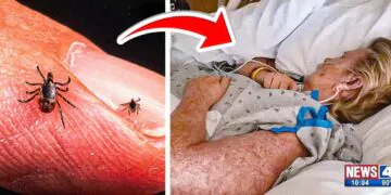 Mom Passes Away After Brushing Off 'Normal' Bug Bites