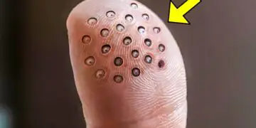 Man Has Weird Round Spots On Finger When The Doctors See It They Call The Cops